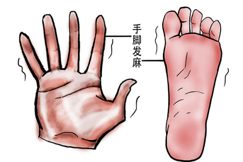 手腳經(jīng)常發(fā)麻是什么原因?手腳發(fā)麻可能患有哪些疾病？